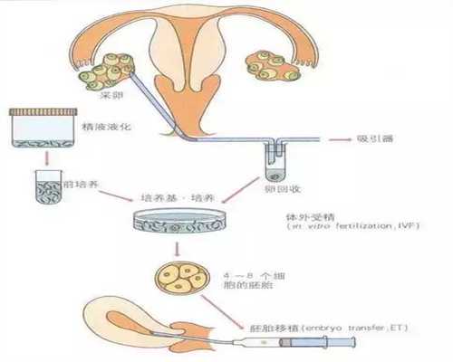 怎么找供卵代孕-供卵试管包成功女孩_专业供卵试管中心-供卵试管哪家放心_供